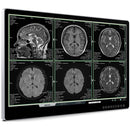 Lilliput Aimedik MD31 31.5" UHD 4K Surgical Monitor