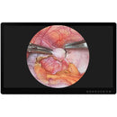 Lilliput Aimedik MD31 31.5" UHD 4K Surgical Monitor
