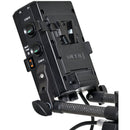 SmartSystem Matrix One Chimera Bundle (V-Mount)